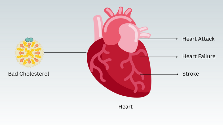 relation of high cholesterol and heart diseases